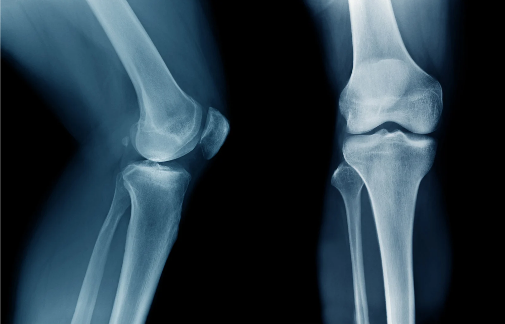 Toma de Radiografías a domicilio